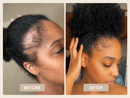 Coil Theory™ Scalp Stimulant