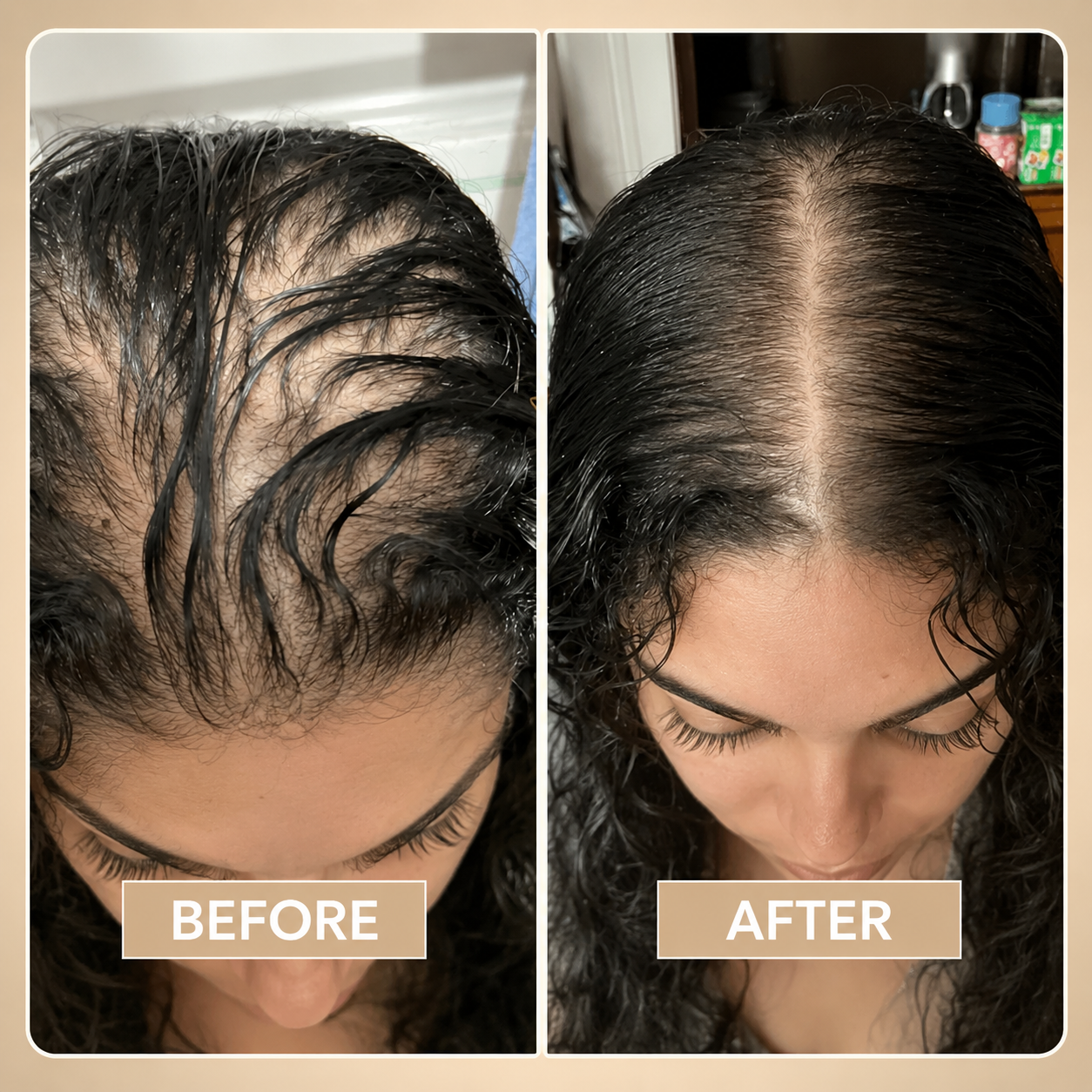 Coil Theory™ Scalp Stimulant