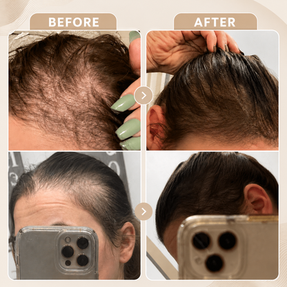 Coil Theory™ Scalp Stimulant