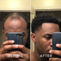 Coil Theory™ Scalp Stimulant
