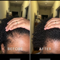 Coil Theory™ Scalp Stimulant