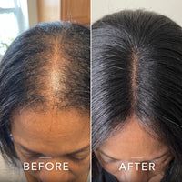 Coil Theory™ Scalp Stimulant