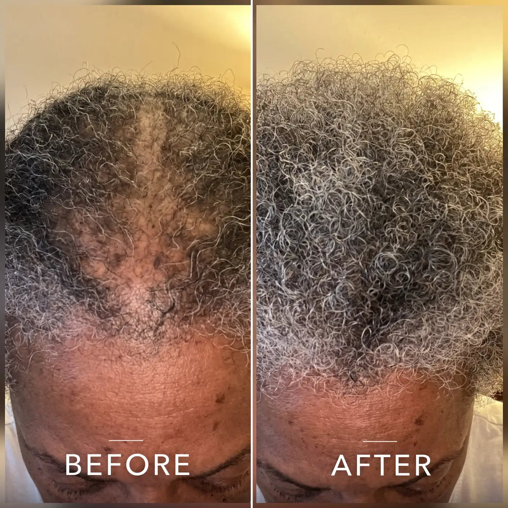 Coil Theory™ Scalp Stimulant
