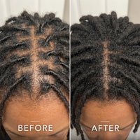 Coil Theory™ Scalp Stimulant