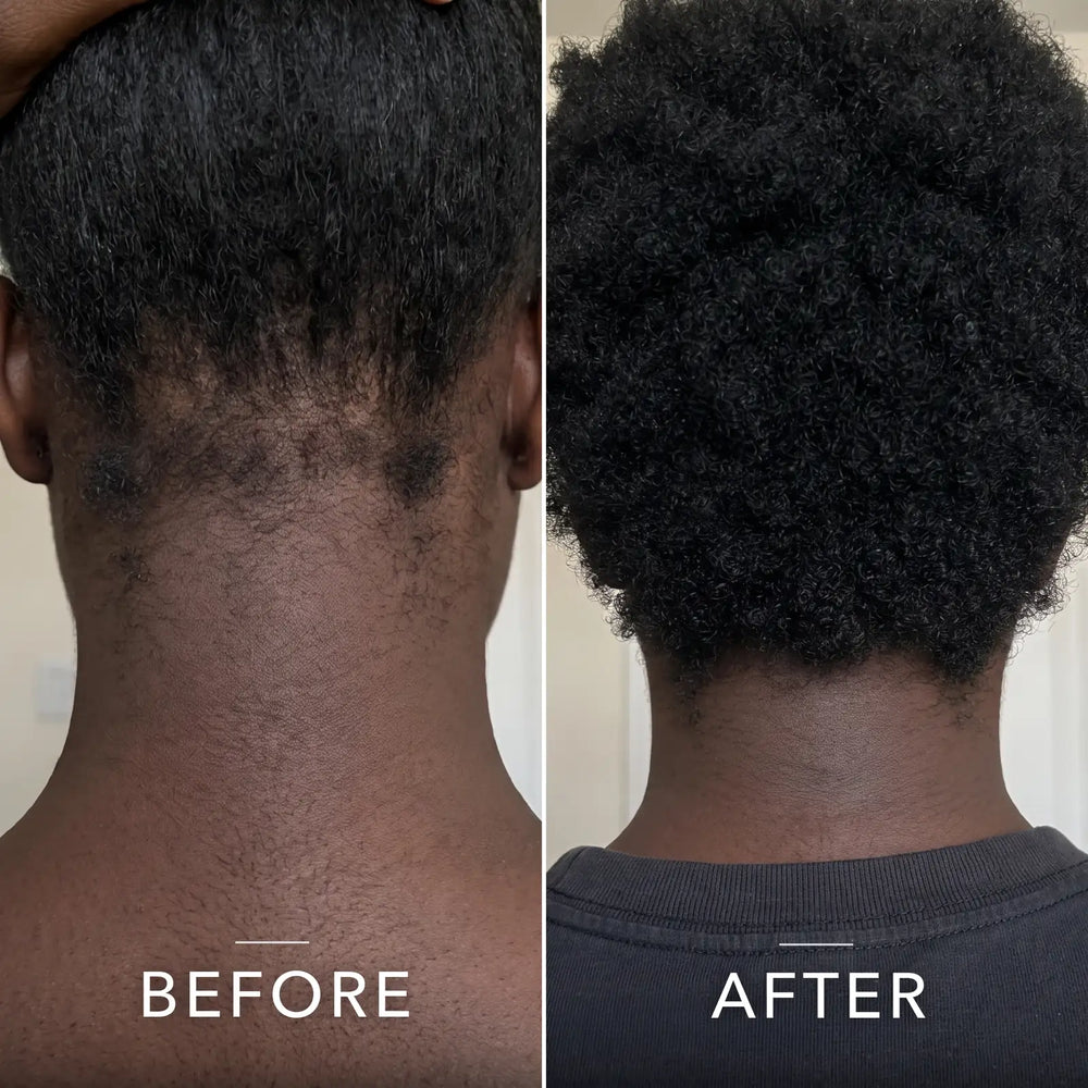 Coil Theory™ Scalp Stimulant