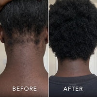 Coil Theory™ Scalp Stimulant
