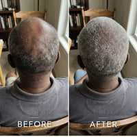 Coil Theory™ Scalp Stimulant