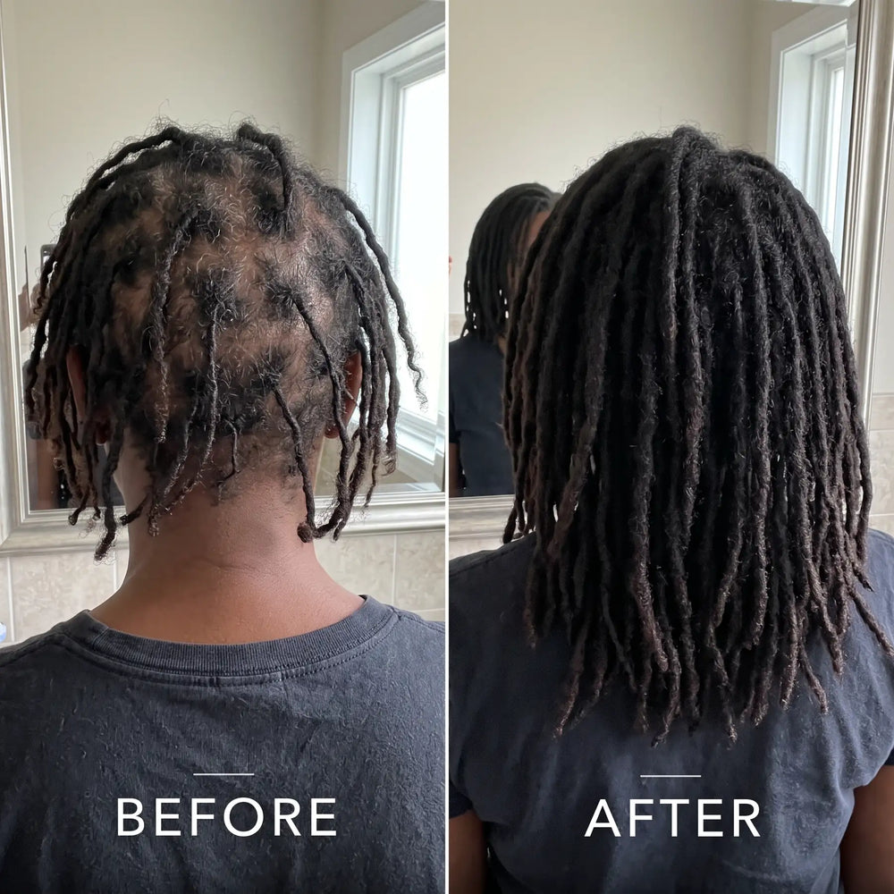 Coil Theory™ Scalp Stimulant
