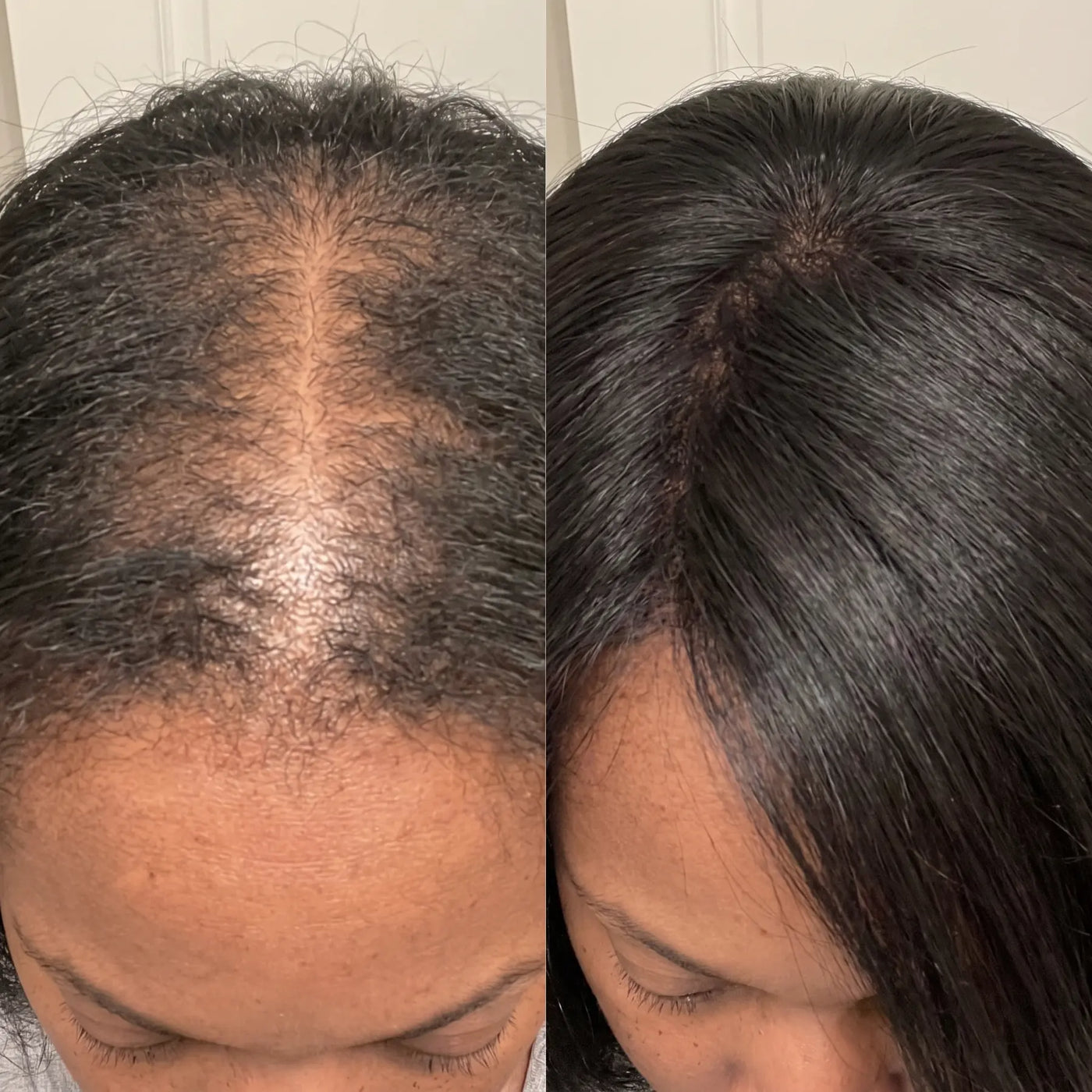 Coil Theory™ Scalp Stimulant